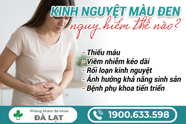 Hình ảnh minh họa